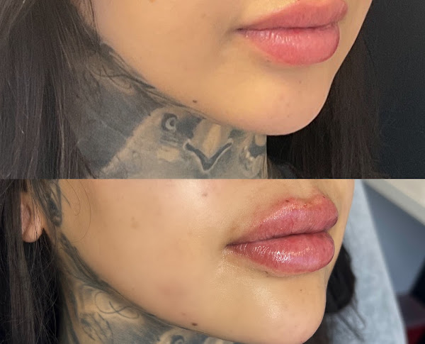 Russian lip