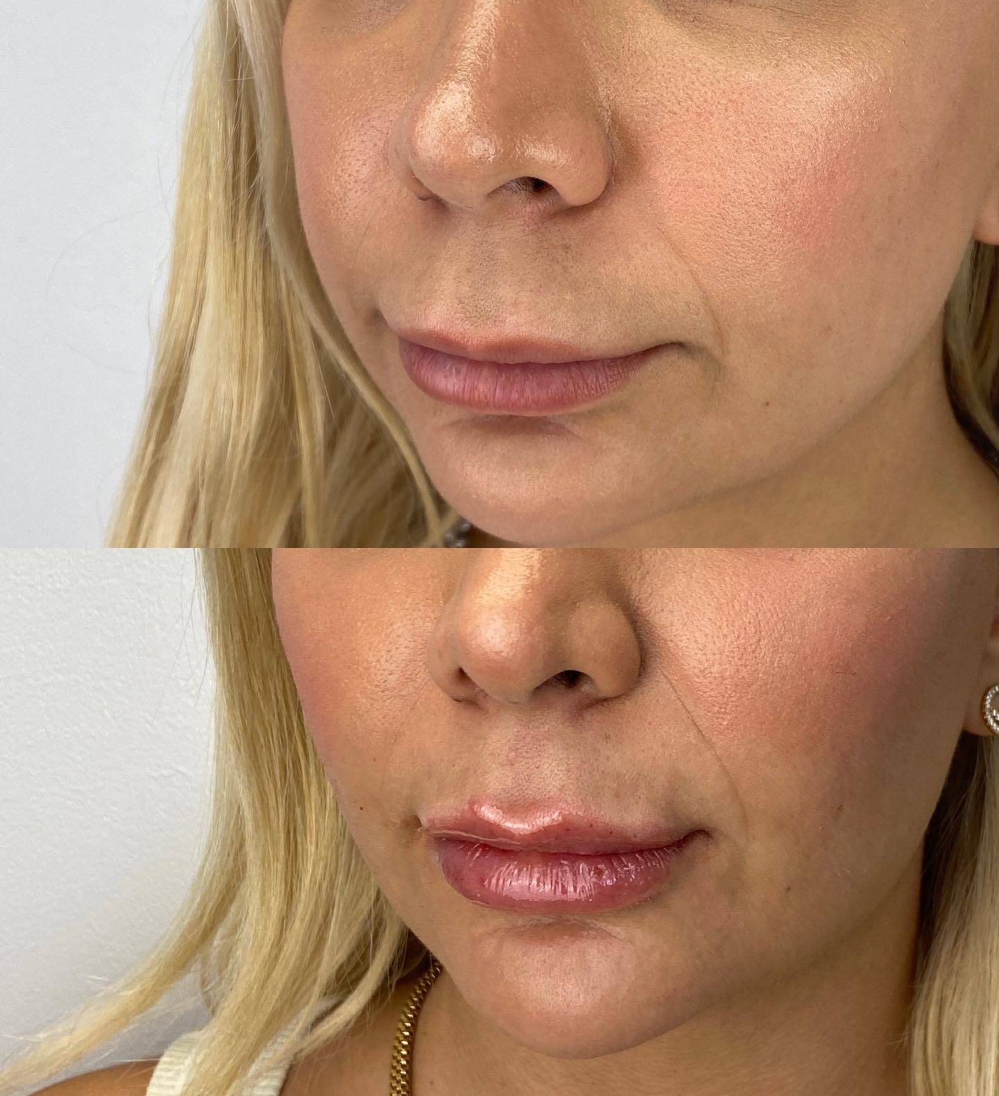 Full-face dissolve + contour