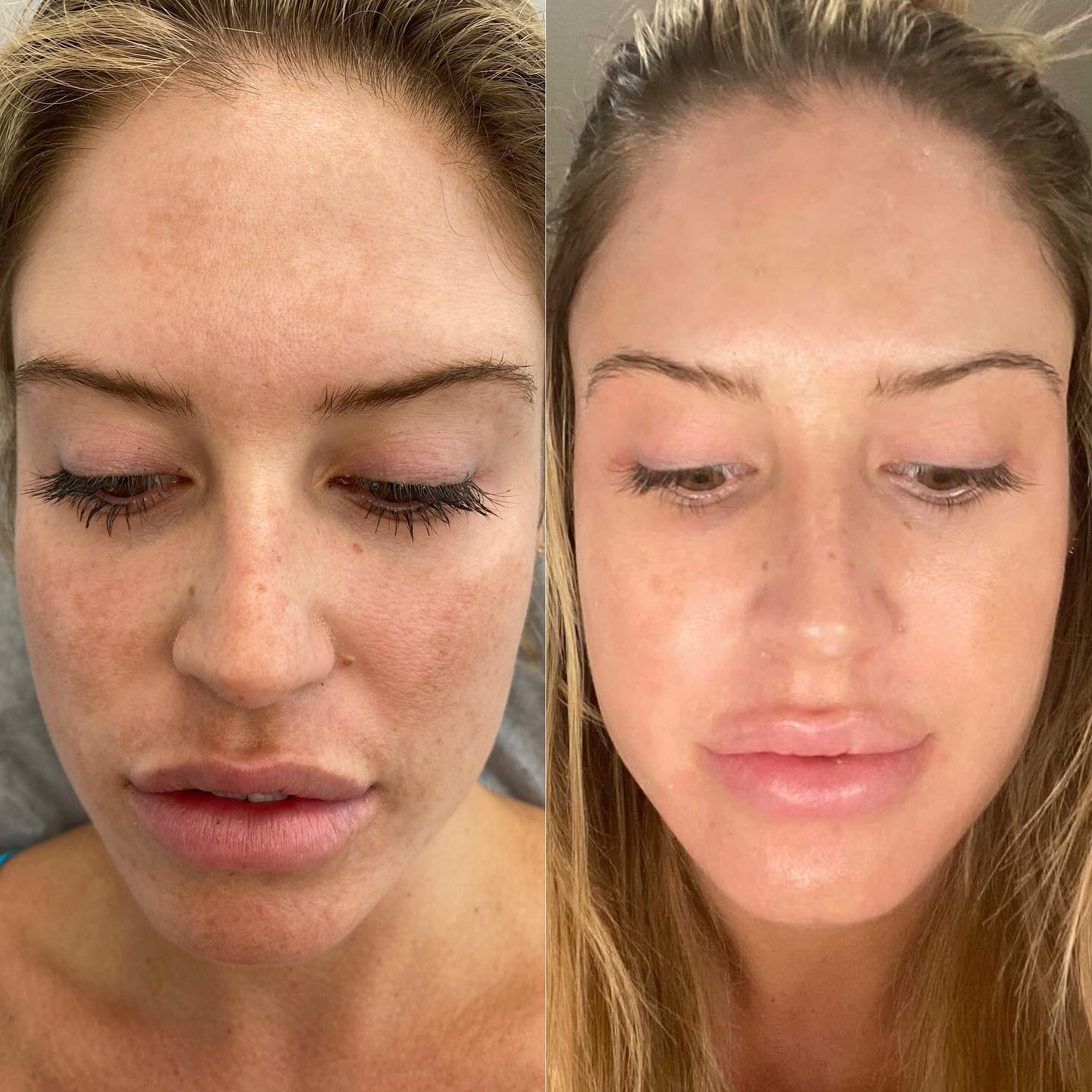 Perfect Derma