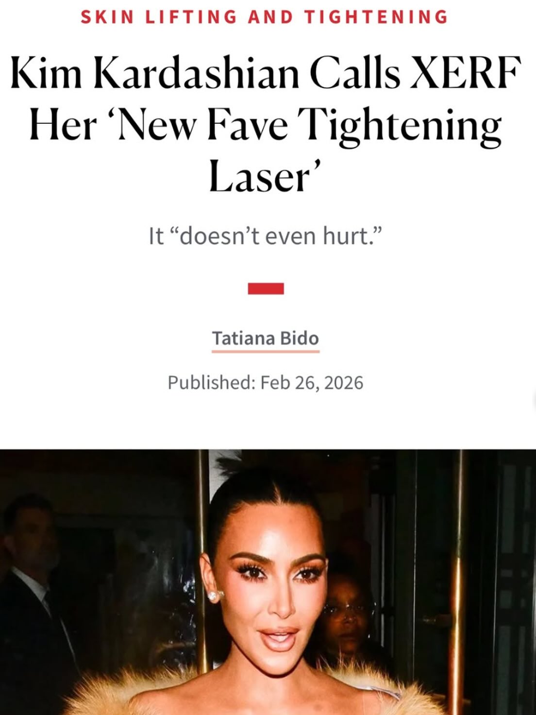 Kim Kardashian article featuring XERF treatment