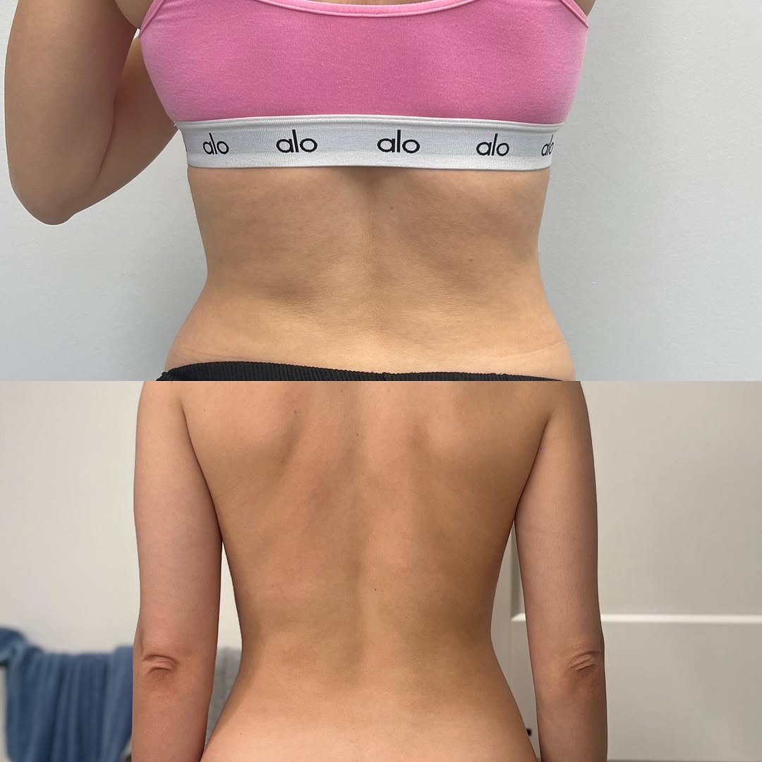 Body