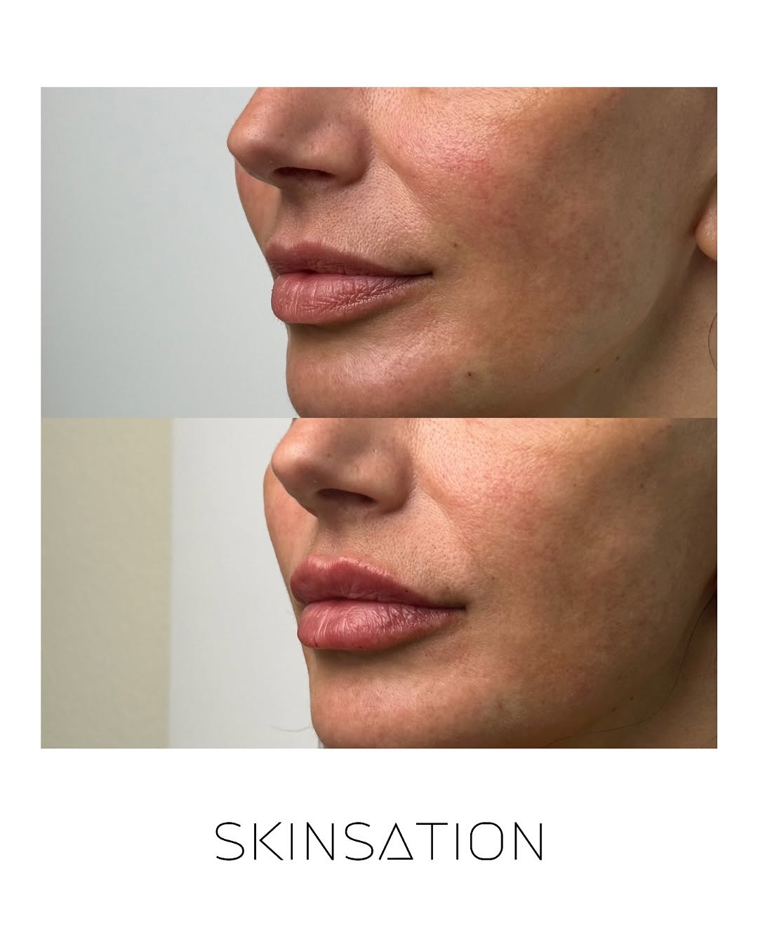 Natural enhancement