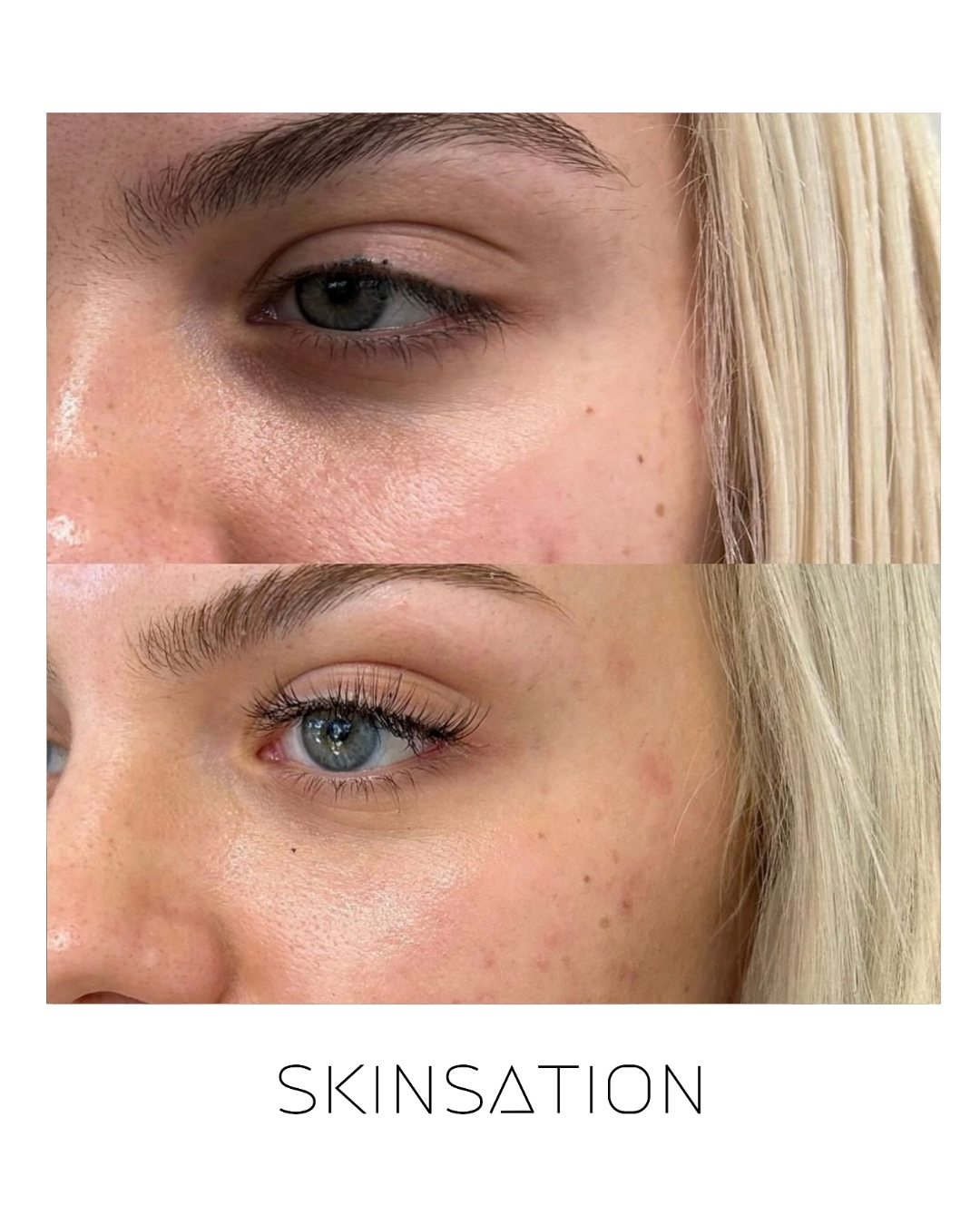 Injectable before and after result 34