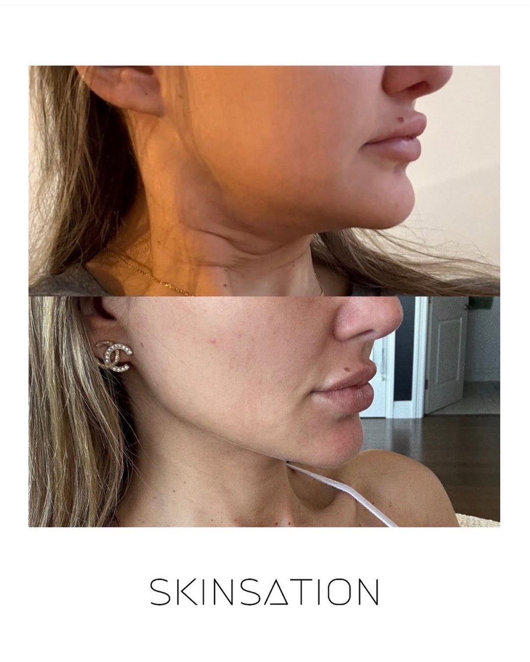 Skin treatment before and after result 6