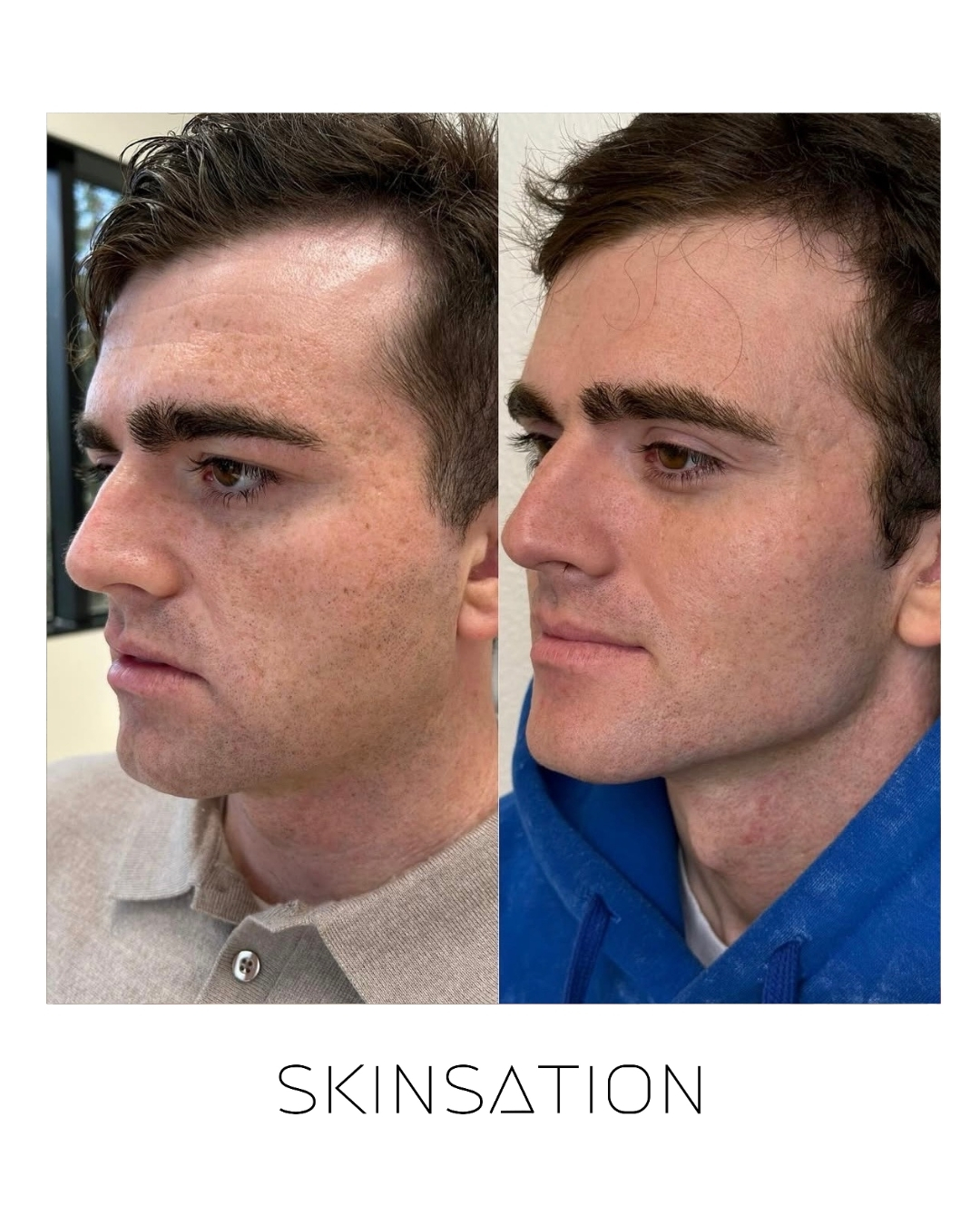 Skin treatment before and after result 12