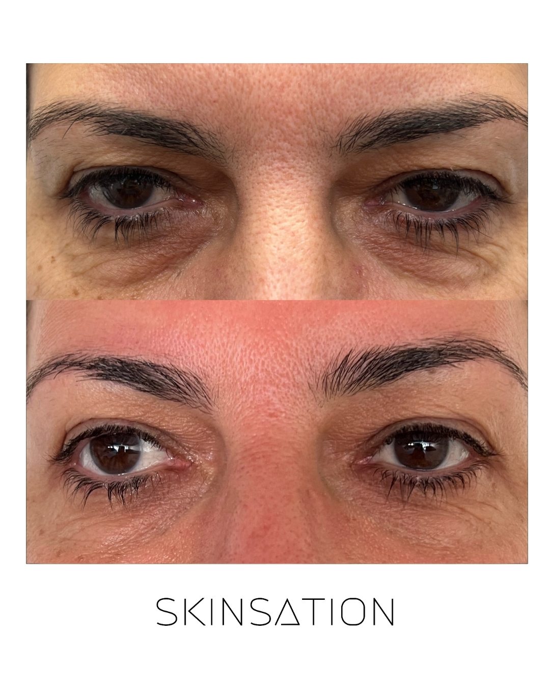 Skin treatment before and after result 27