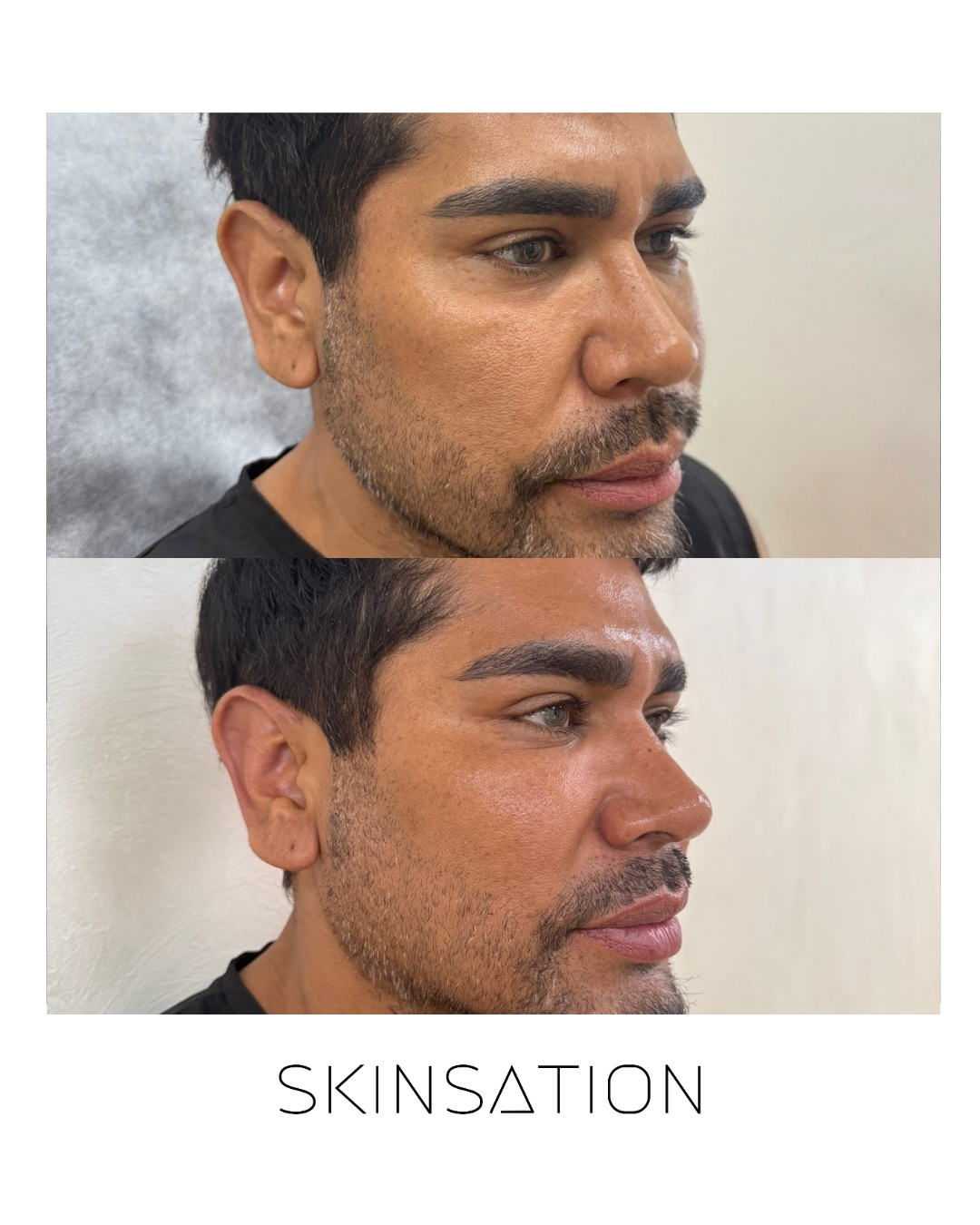 Skin treatment before and after result 28