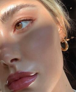 Skin tightening botox and lip fillers by skinsation la