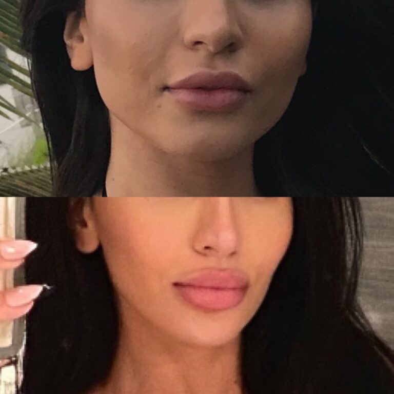 Client results using only Morpheus for face