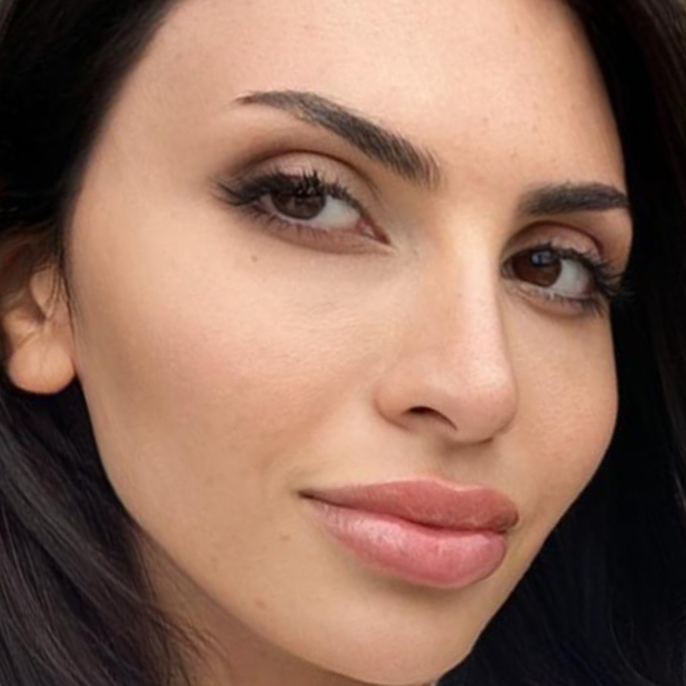 Morpheus8 treatment for face after