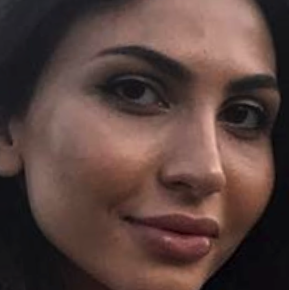 morpheus8 treatment for face before