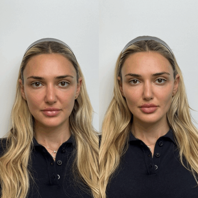 Screen Shot 2025 07 06 at 3.40.26 PM