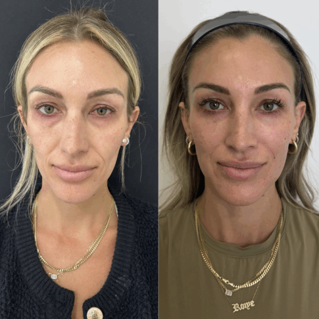 Screen Shot 2025 07 06 at 3.40.31 PM